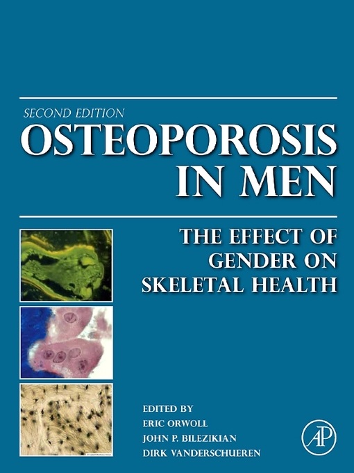 Title details for Osteoporosis in Men by Eric S. Orwoll - Available